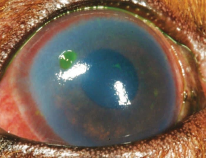 Úlcera de córnea destacada pelo colírio fluoresceína (verde). Imagem: Cavalier Health